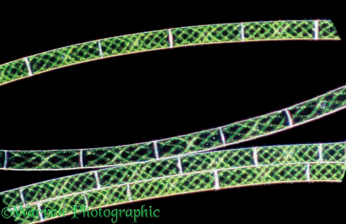 Filamentous green algae (Spirogyra sp) showing cell structure